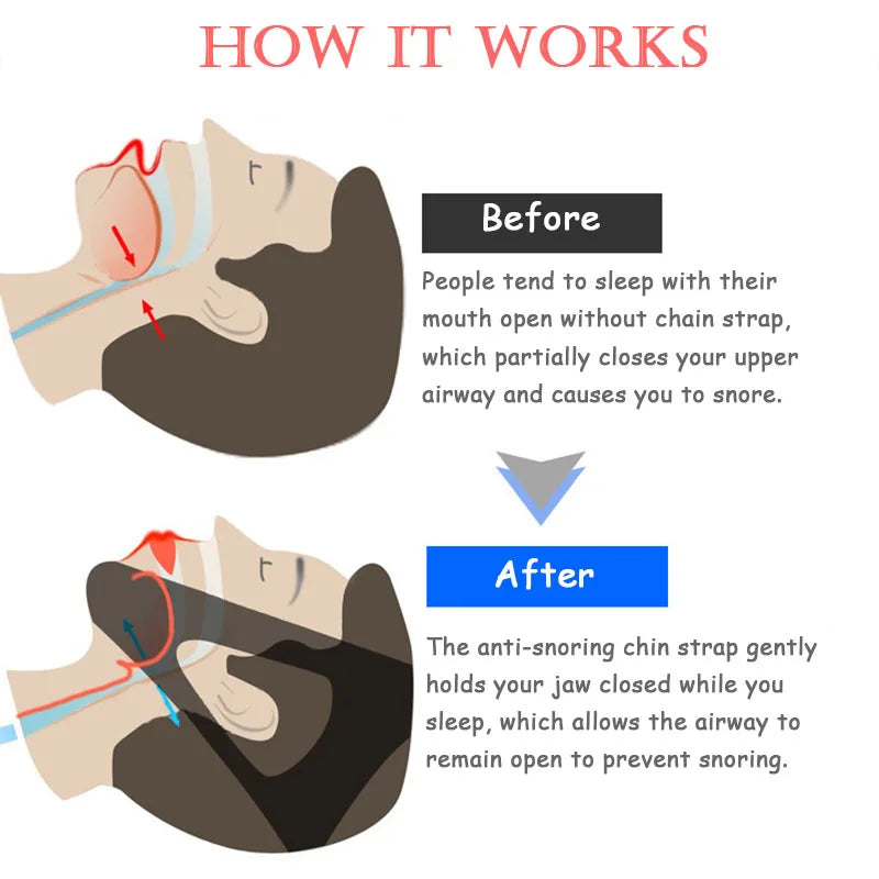 Neoprene anti Snoring Chin Strap Stop Snore Jaw Belt Snore Stopper Sleep anti Apnea Chin Support Straps Night Sleeping Aid Tools